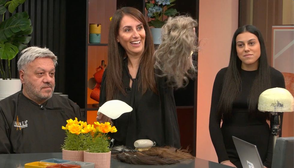 Model Jengiz explained how he lost his hair at 21-years-old.