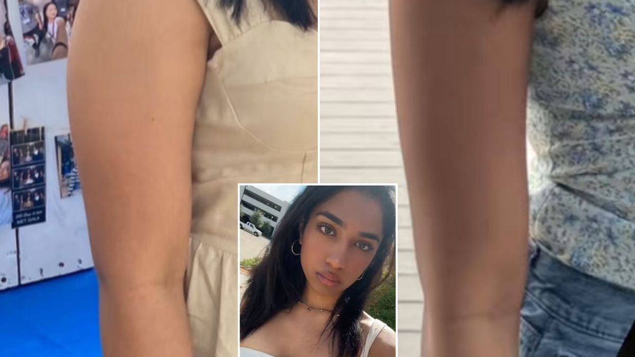 Molli before and after arm transformation