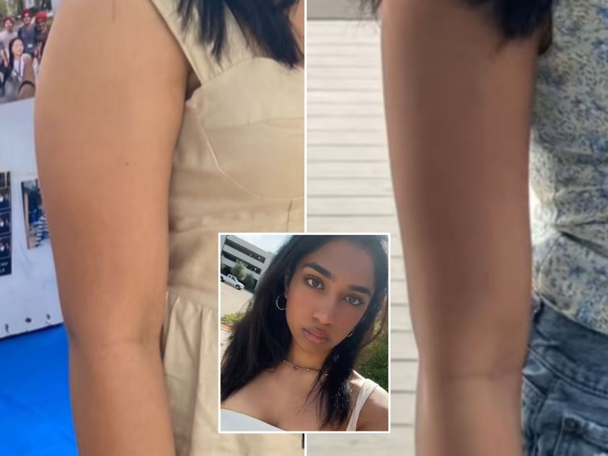 Molli before and after arm transformation