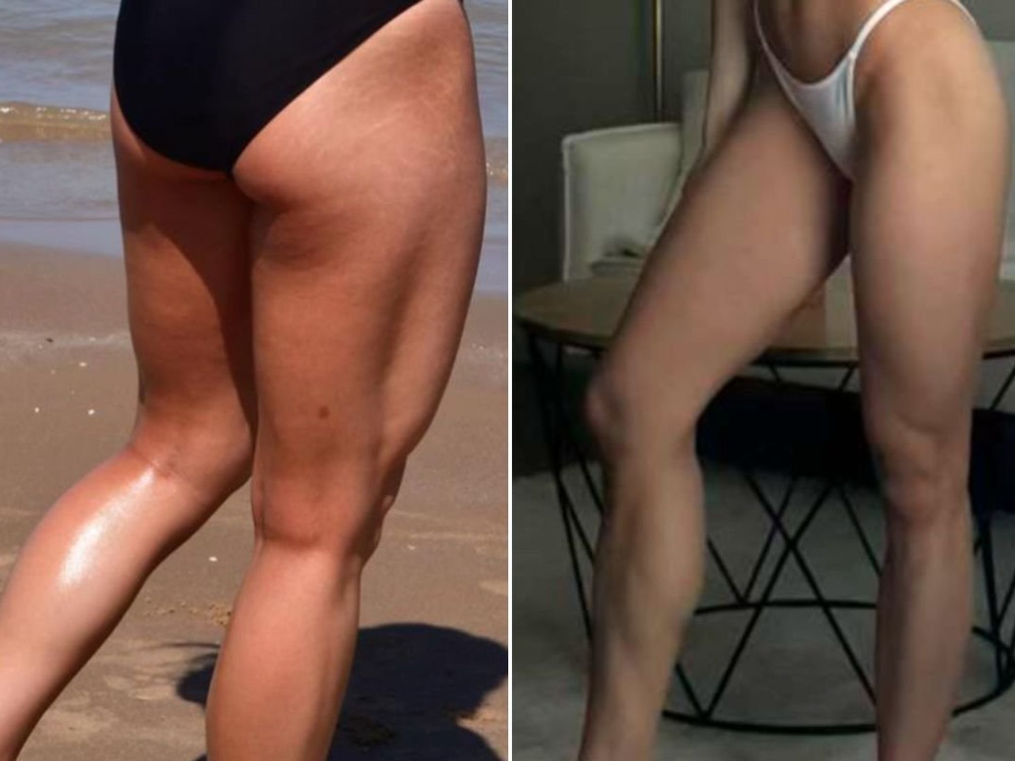 MONET BEFORE AND AFTER