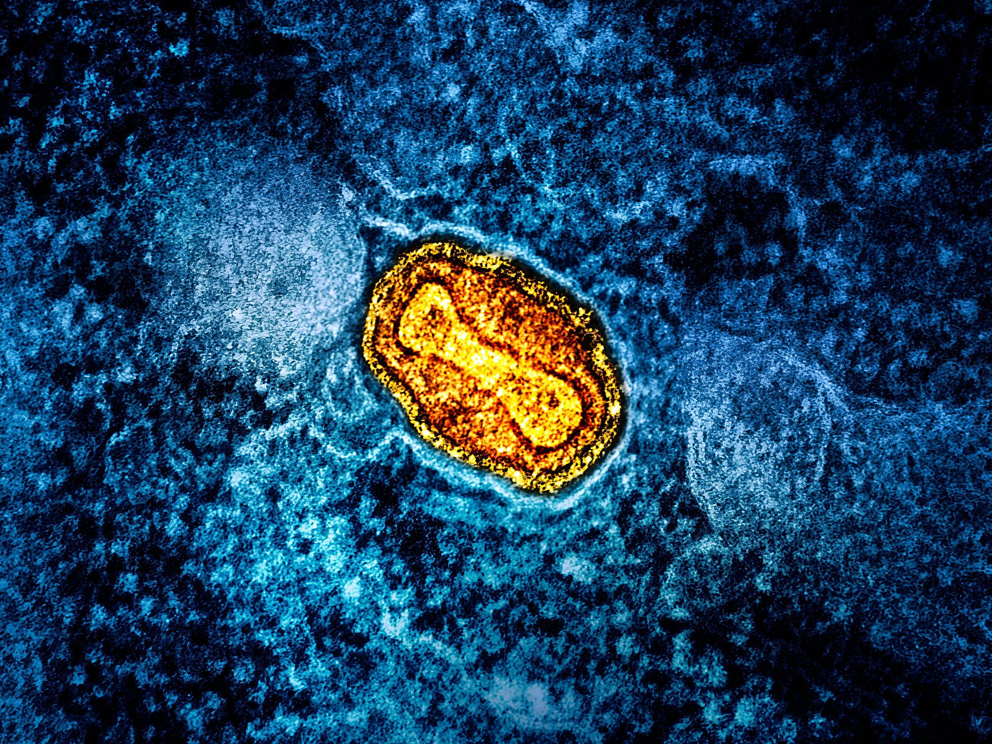 mpox under microscope