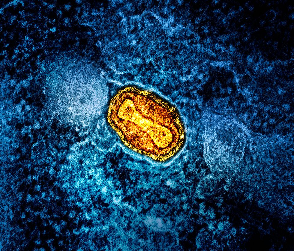 mpox under microscope