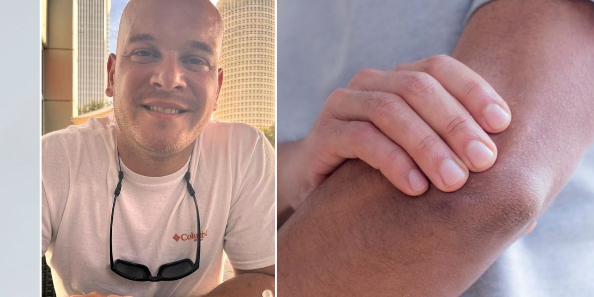NextImg:Father who blamed twitch in his arm on pinched nerve given devastating diagnosis eight months later