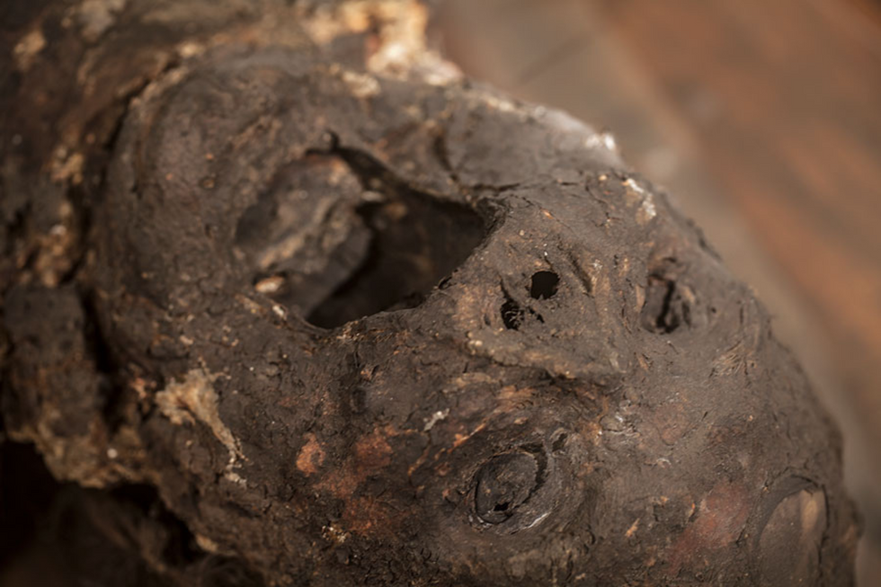 Mrs Ellenbogen saponified corpse