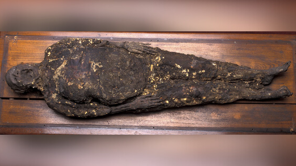 Mrs Ellenbogen saponified corpse