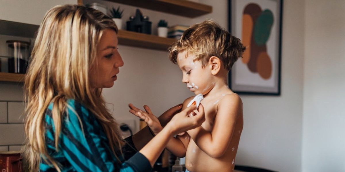 Measles outbreak: Unvaccinated children could be excluded from schools as health chiefs admit: ‘We’re worried’ Measles outbreak: Unvaccinated children could be excluded from schools as health chiefs admit: ‘We’re worried’