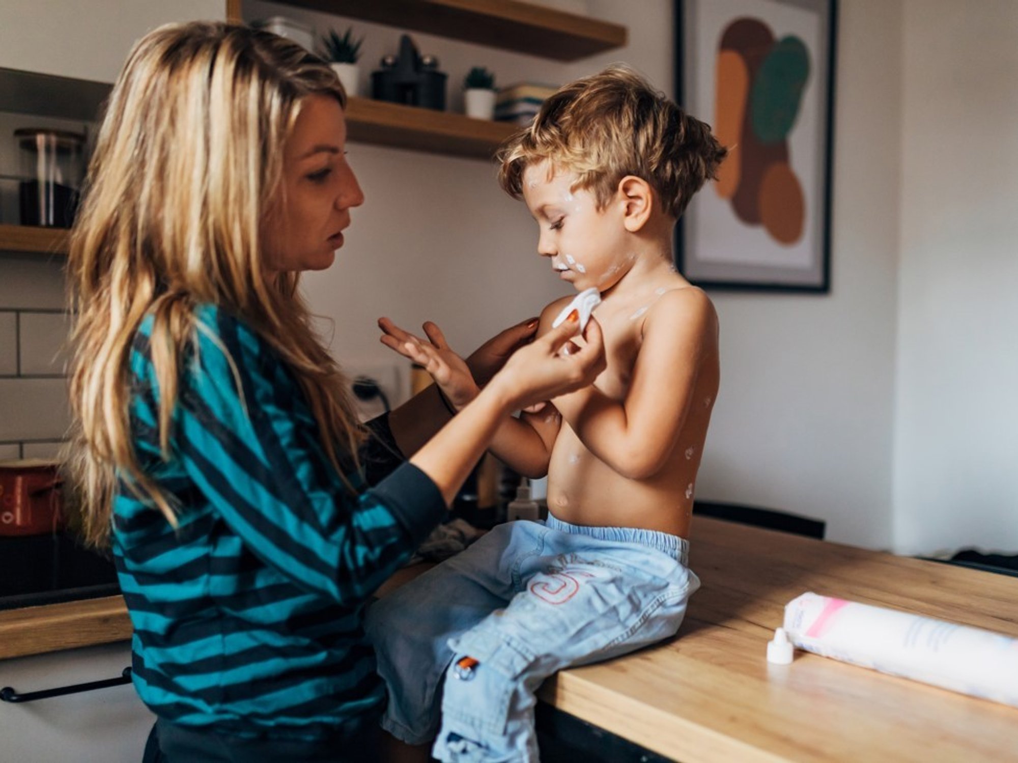 Mum taking care of her son who has measles