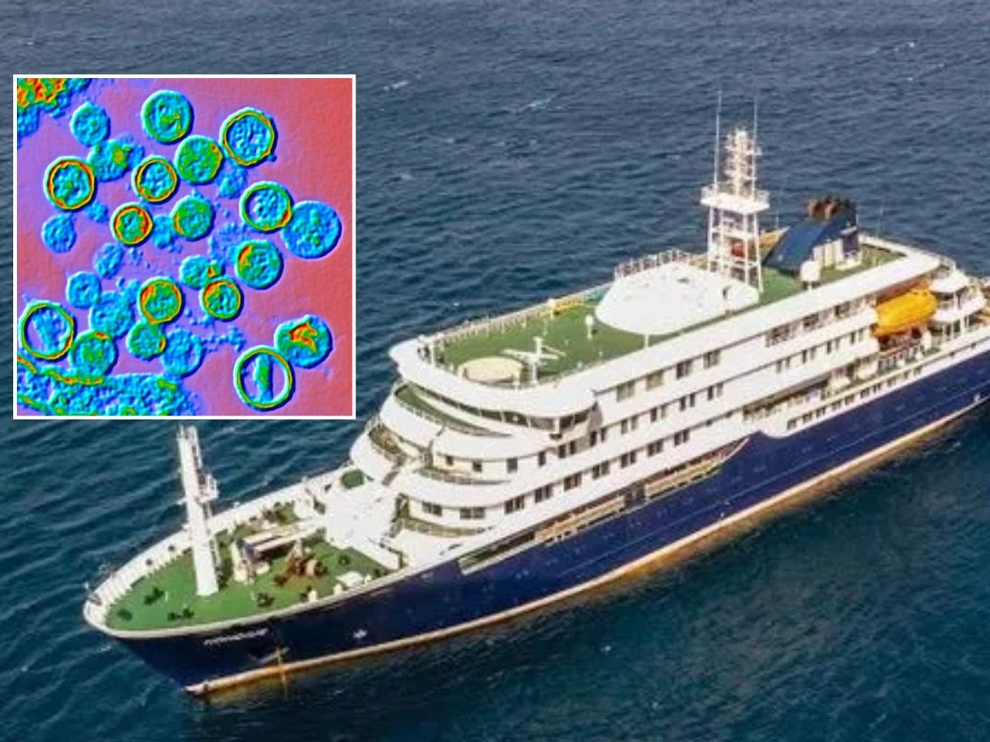 MV Hondius and hantavirus under microscope