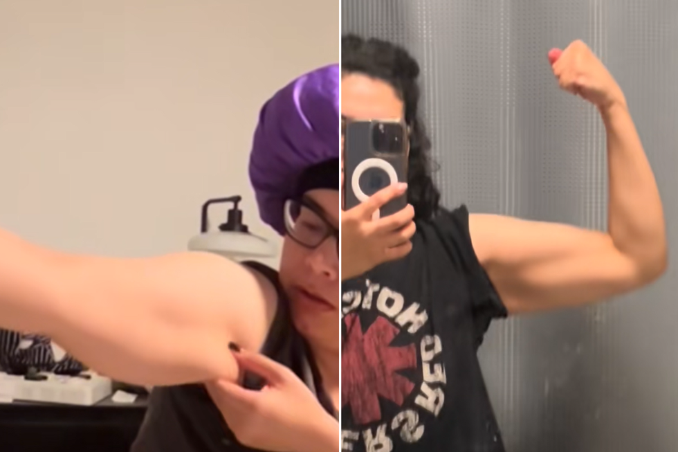 Nanda's before and after pictures of her arms