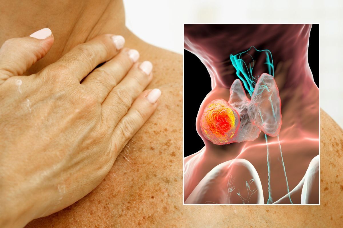 NECK PAIN AND CANCER ILLUSTRATION