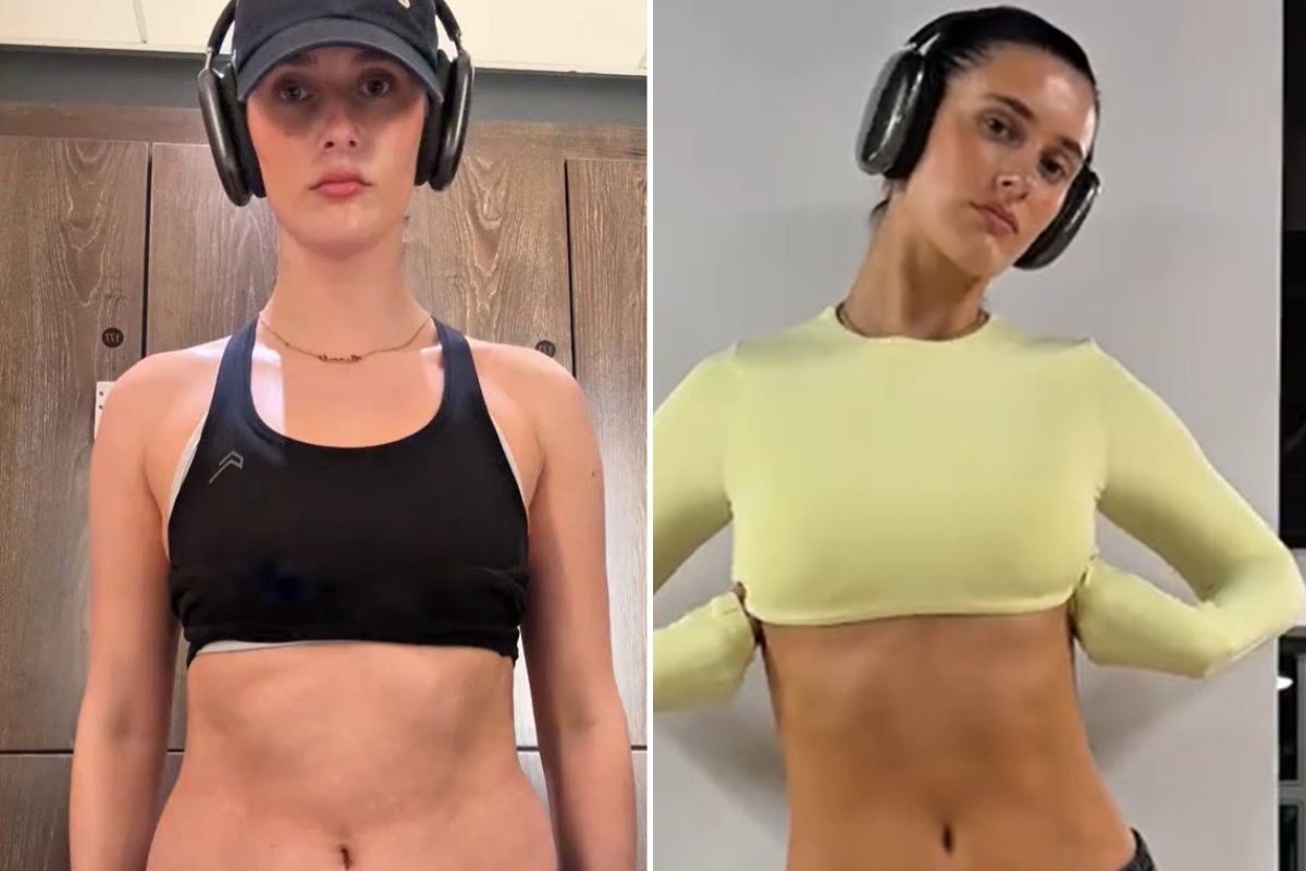 NIAMH BEFORE AND AFTER PICS