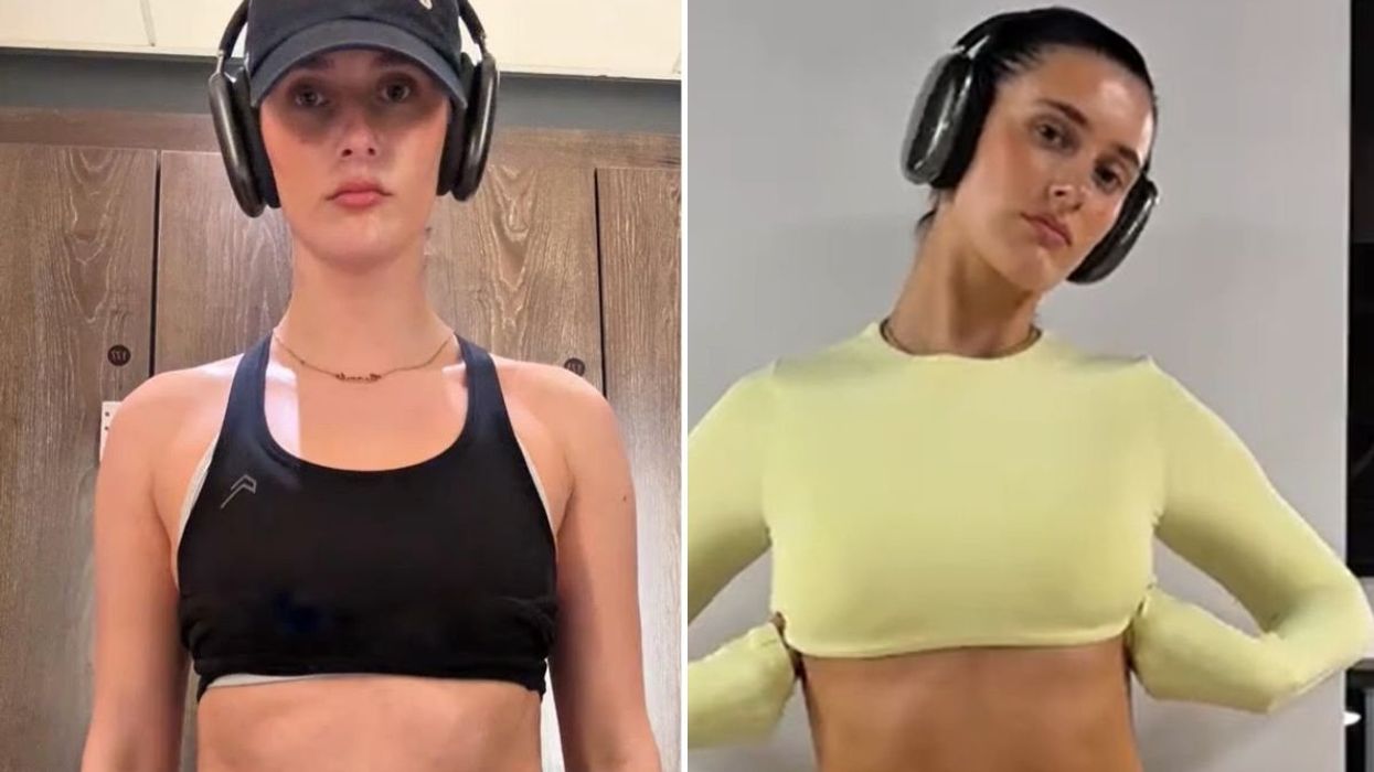 NIAMH BEFORE AND AFTER PICS