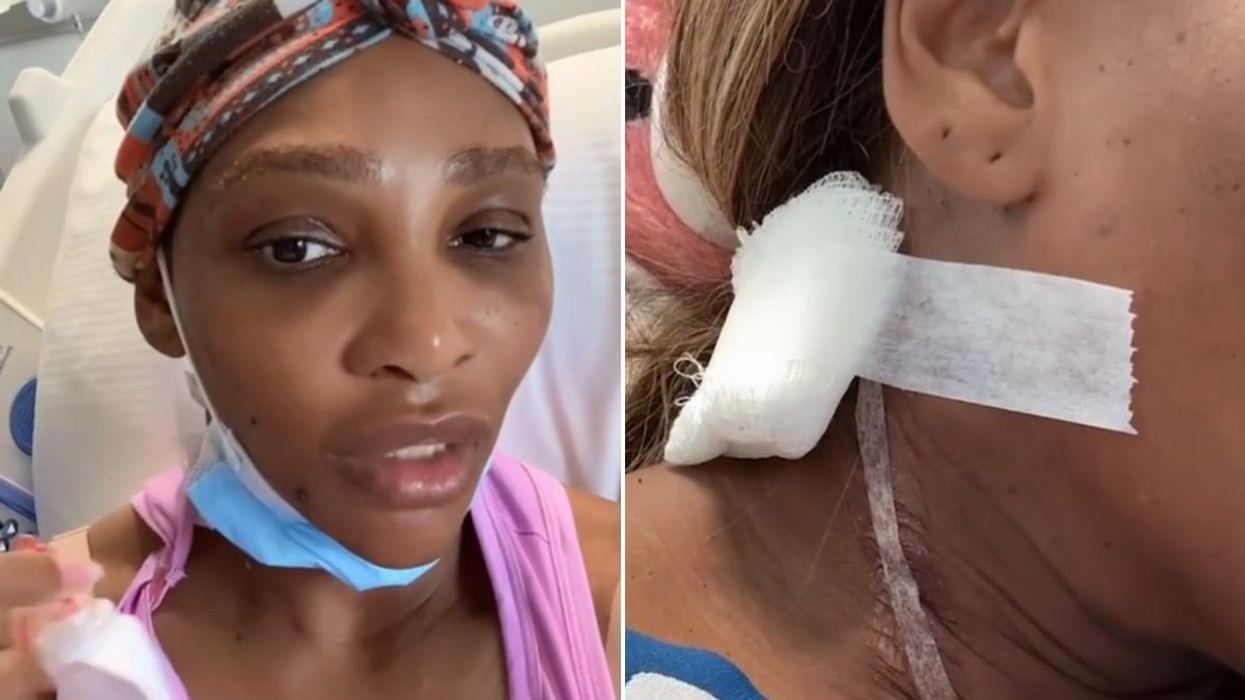 Serena Williams provides health update after surgery to remove 'lump size of a small grapefruit'