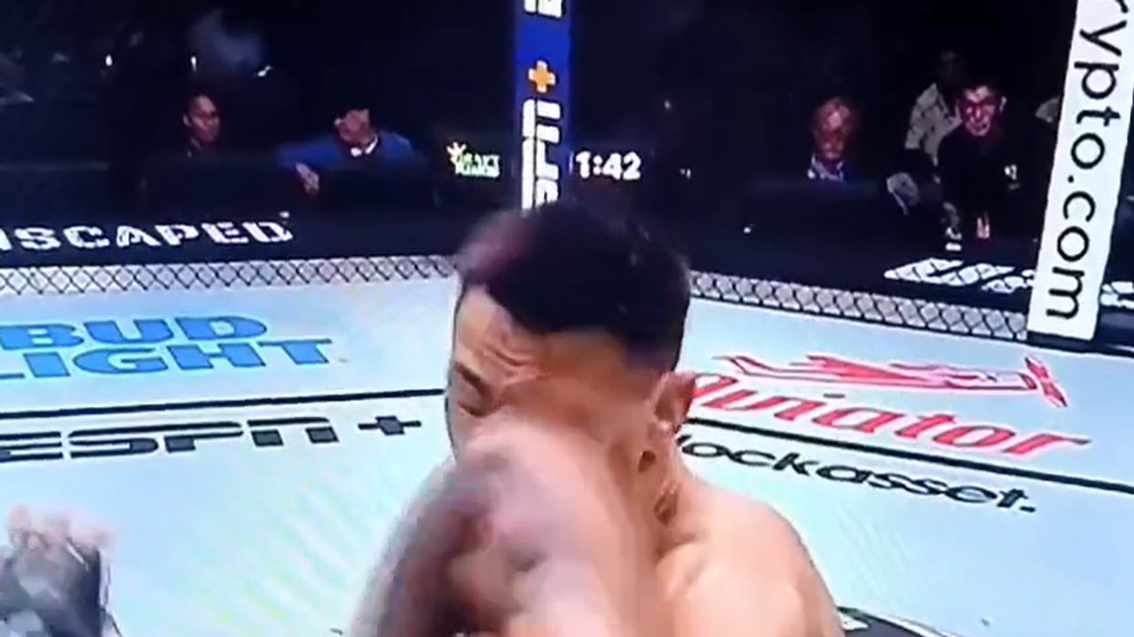 UFC star 'might go blind' after horrific eye injury that fractured several bones