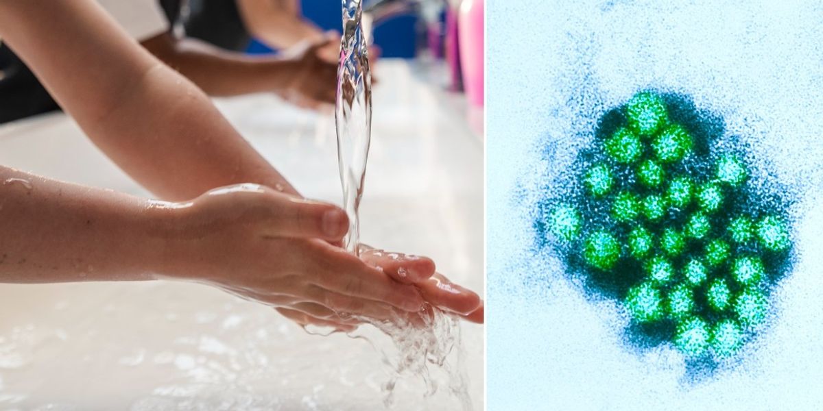 NextImg:Urgent health warning issued over viral bug that causes diarrhoea and vomiting amid fears of spread in children