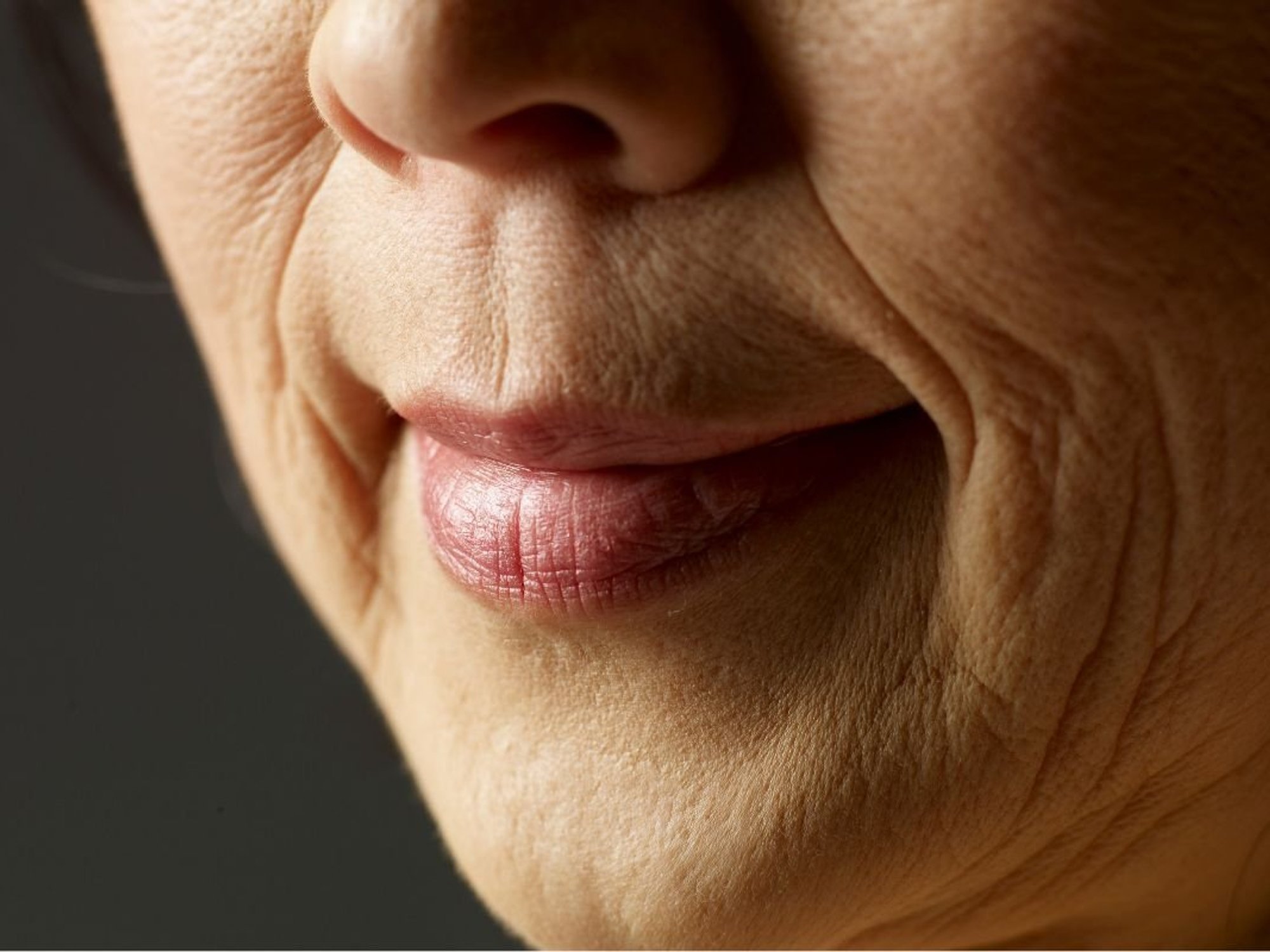 NOSE CLOSE UP