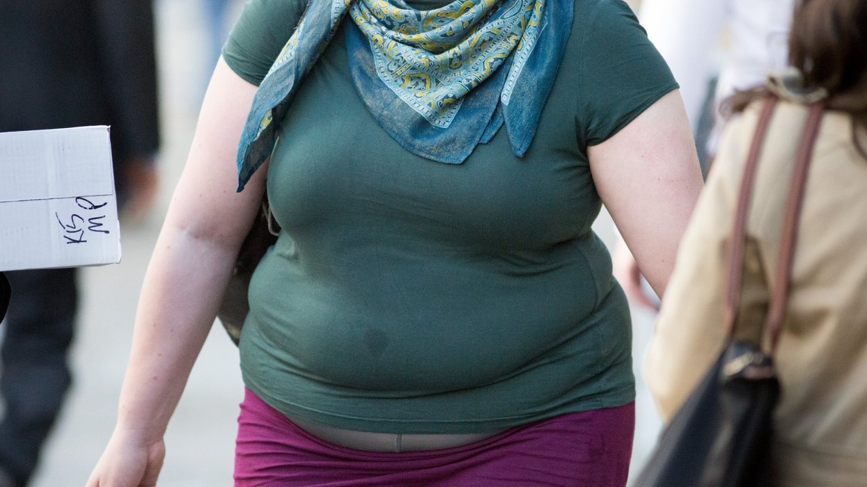 Obese woman