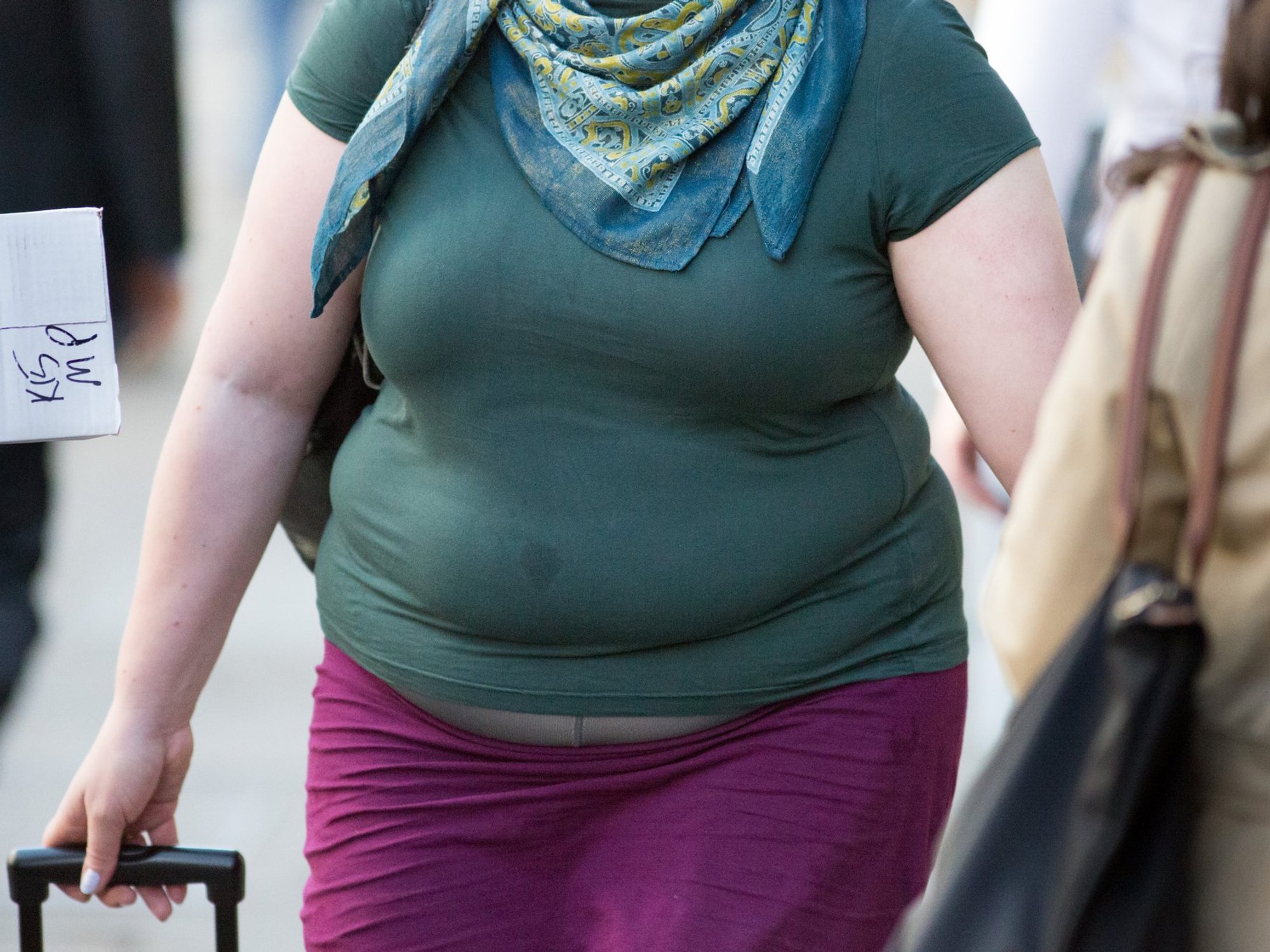 Obese woman