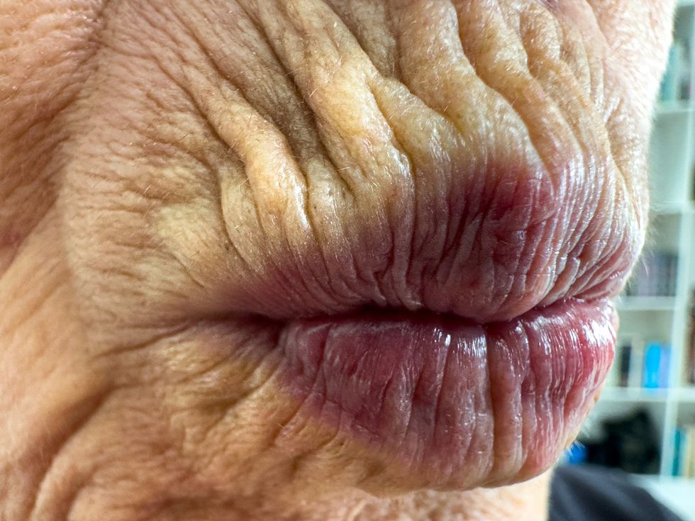 Older woman pursing her lips