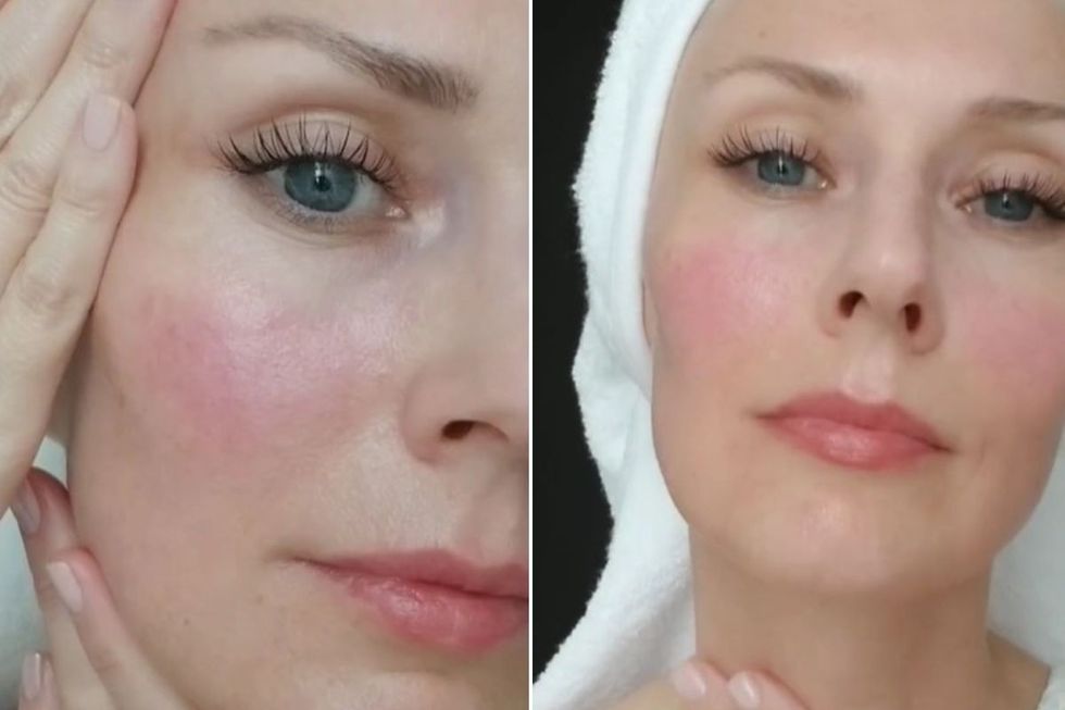 OLGA APPLYING SKIN CARE