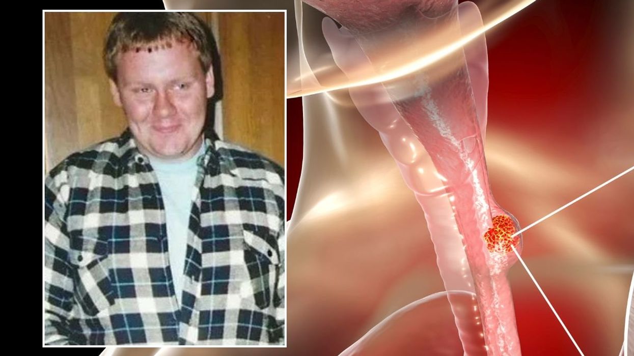 OSEOPHAGUS AND HEADSHOT OF MICHAEL