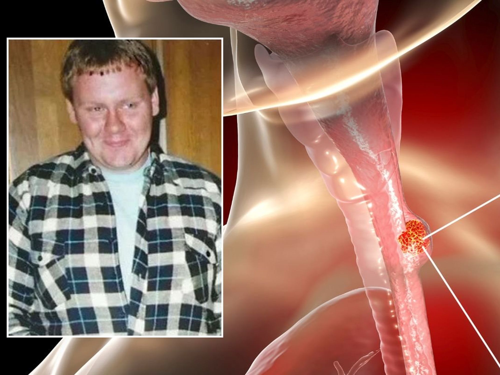 OSEOPHAGUS AND HEADSHOT OF MICHAEL