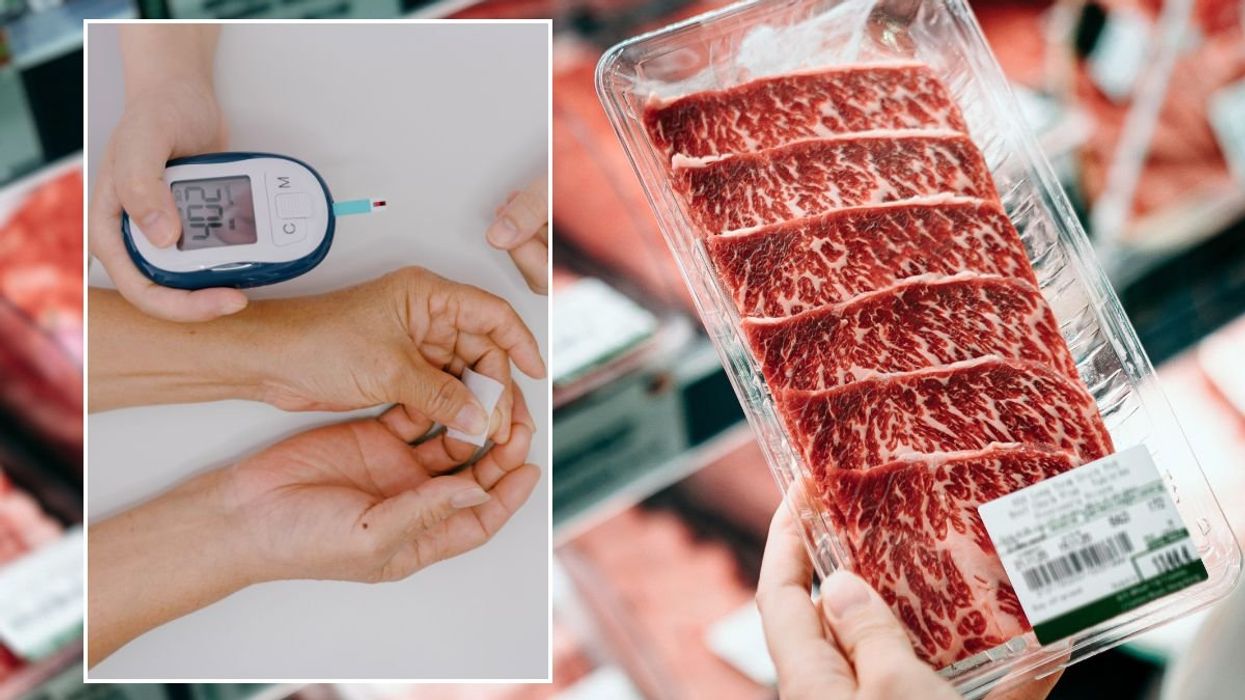 PACKET OF MEAT AND BLOOD SUGAR MONITOR