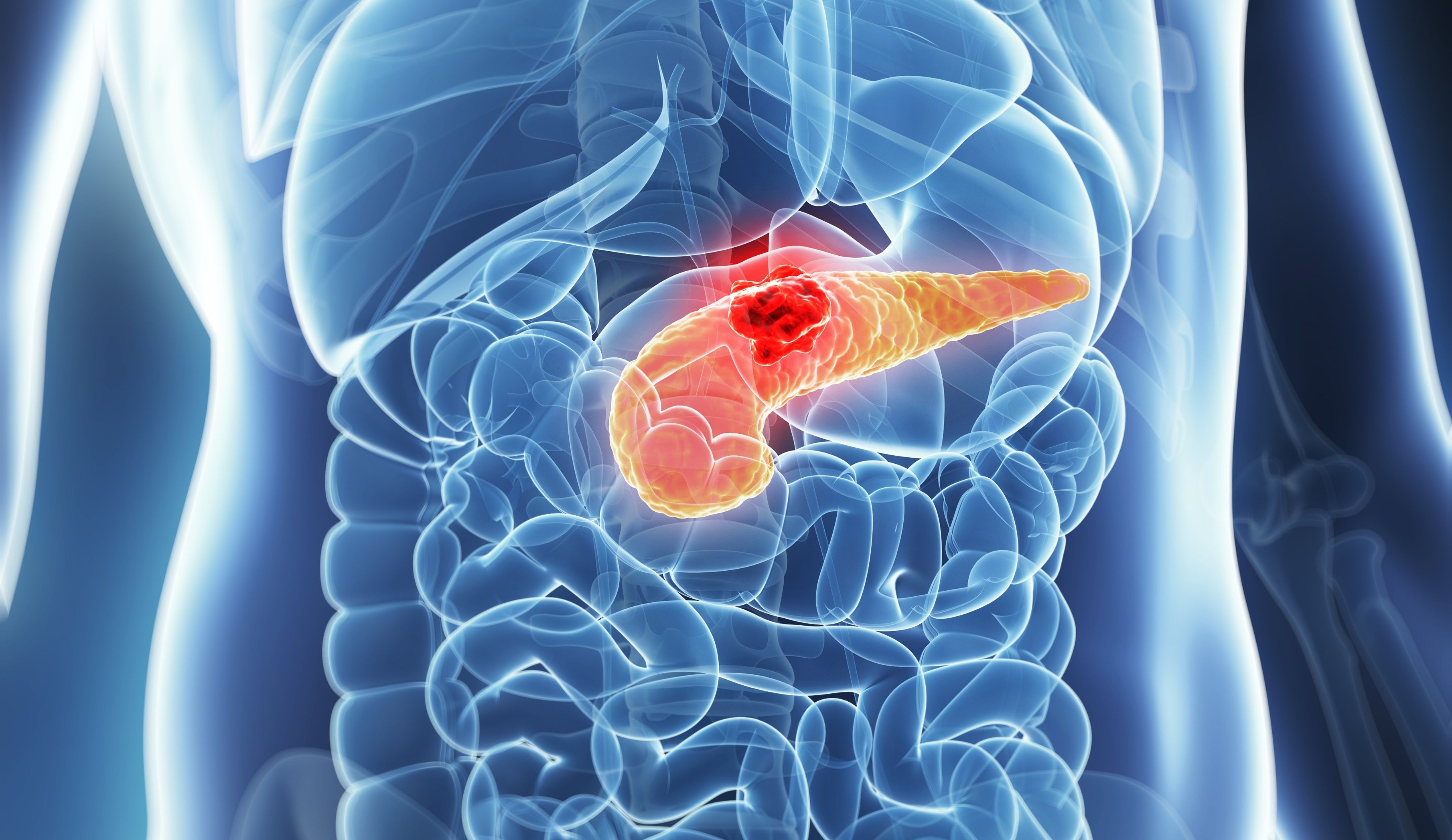 PANCREAS COMPOSITE