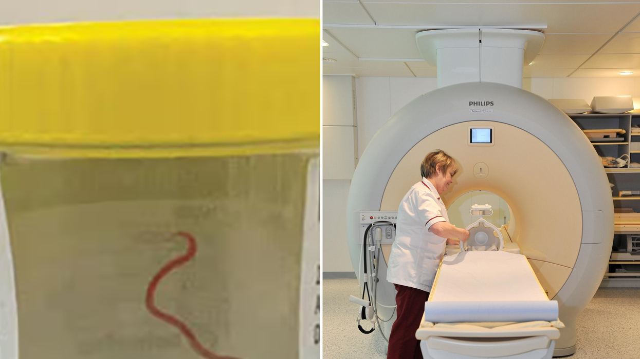 Parasitic worm and MRI scan (stock) composite