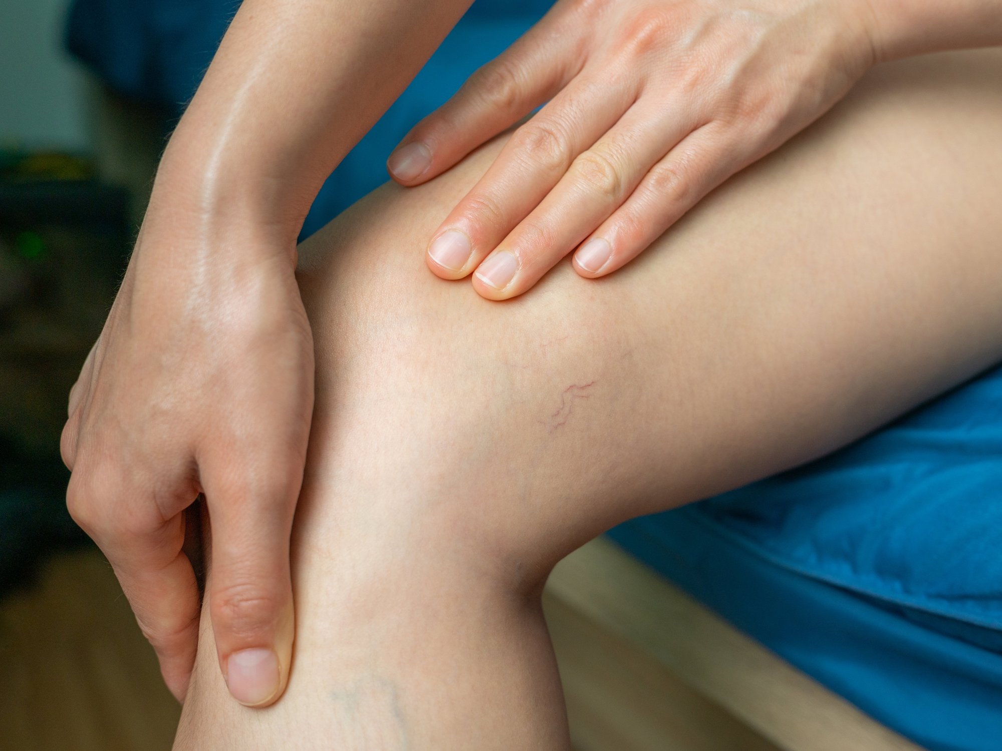 PATIENT WITH LEG PAIN