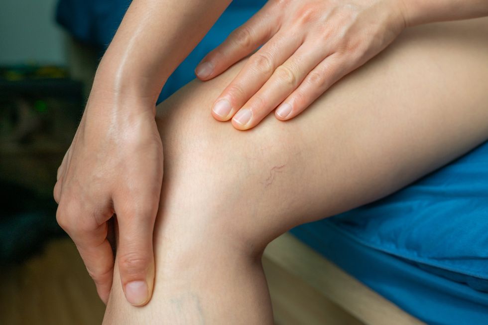 PATIENT WITH LEG PAIN