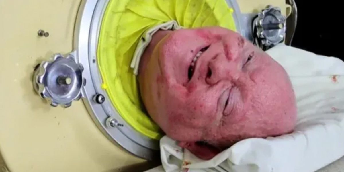 NextImg:Iron lung man Paul Alexander dies aged 78 after spending 70 years in a living in a tank