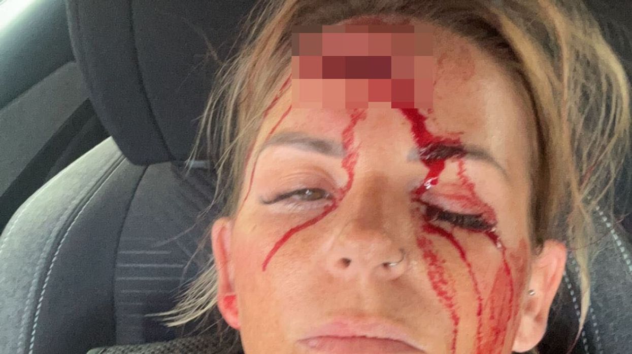PC Woods was assaulted while attempting to make an arrest in Wakefield