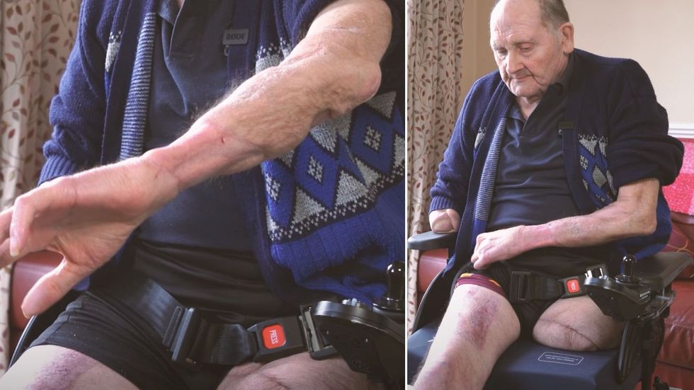 Pensioner with injuries from dog attack