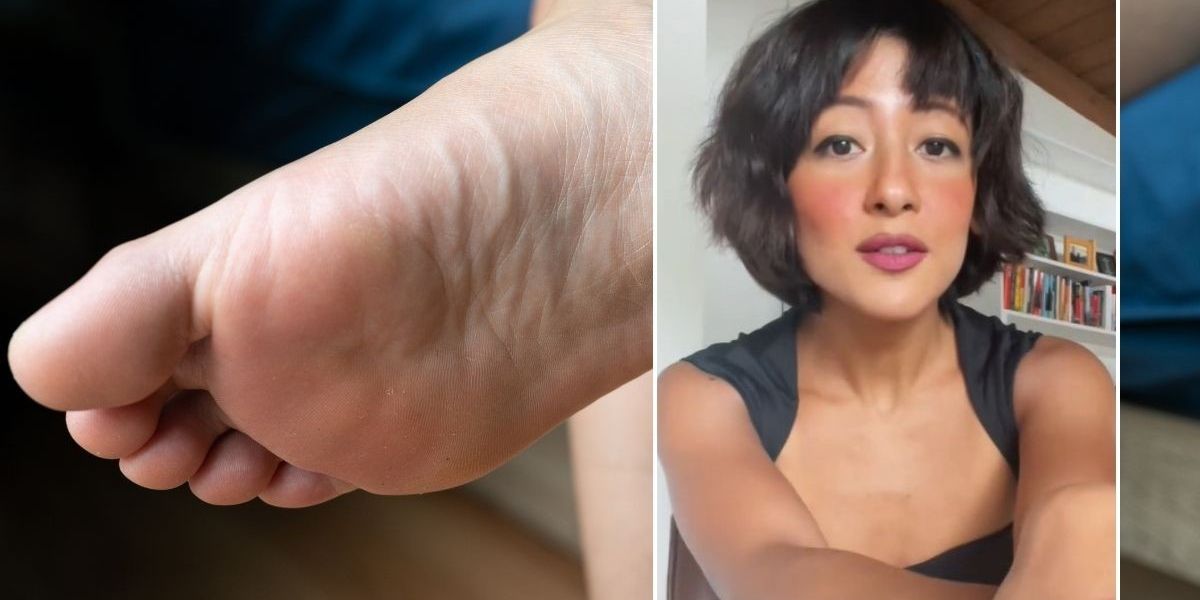 How to cure sandpaper feet: ‘My 20-minute routine restores cracked heels