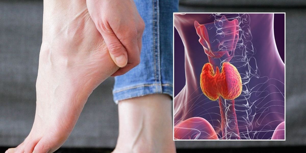 NextImg:Cracked heels: Doctor warns dry feet could signal 3 hidden health conditions