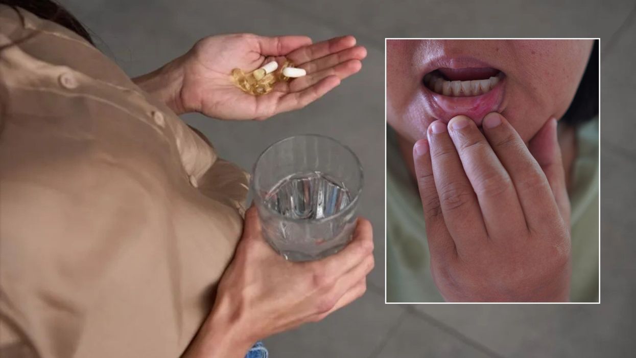 Person taking vitamin B12 tables/individual checking mouth ulcers
