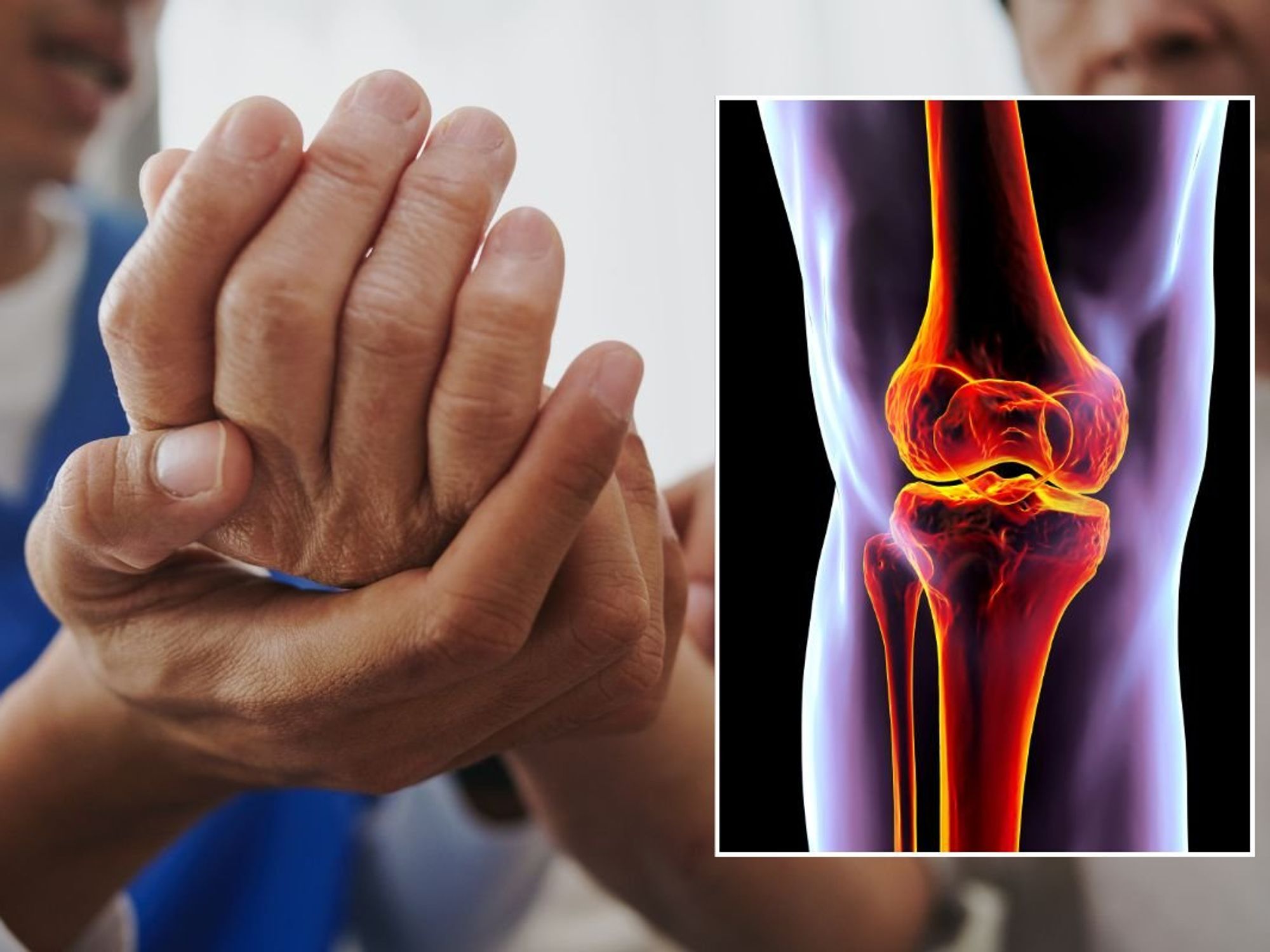 person with joint pain in hand