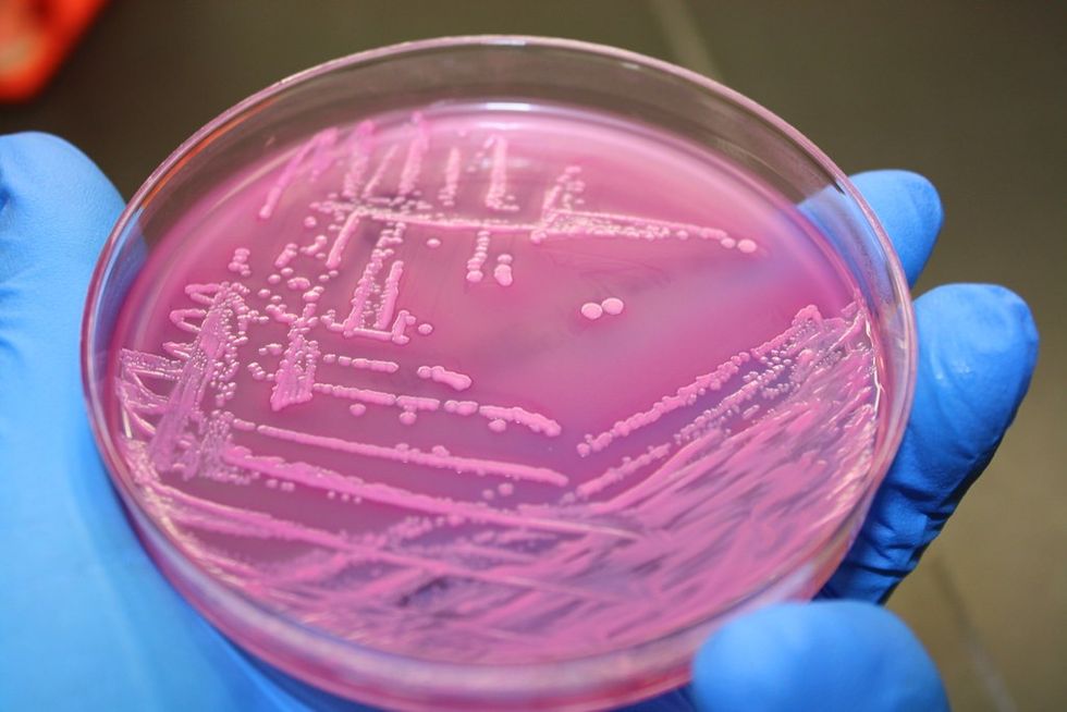 PETRI DISH