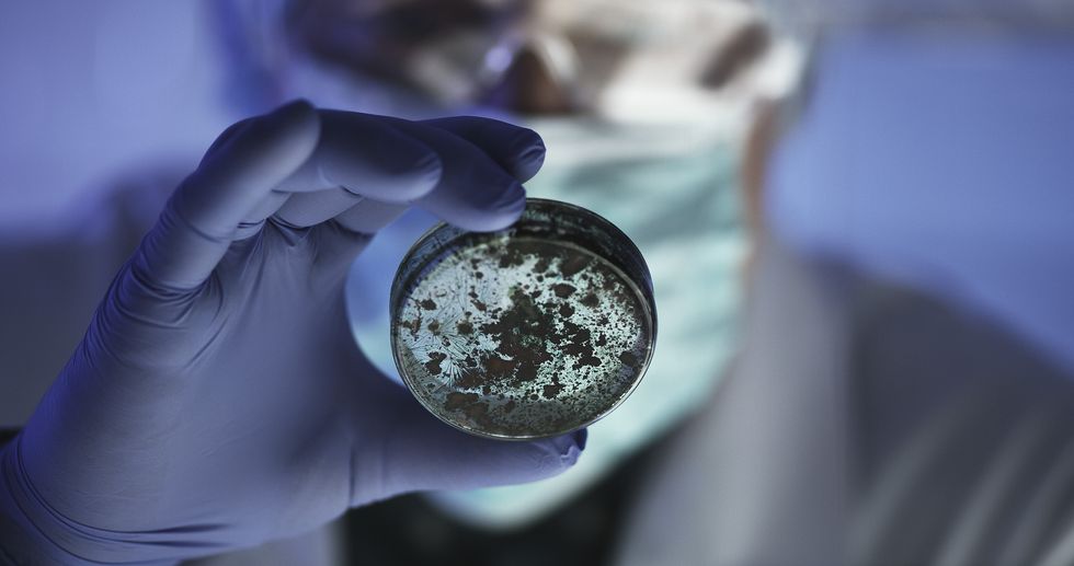 PETRI DISH