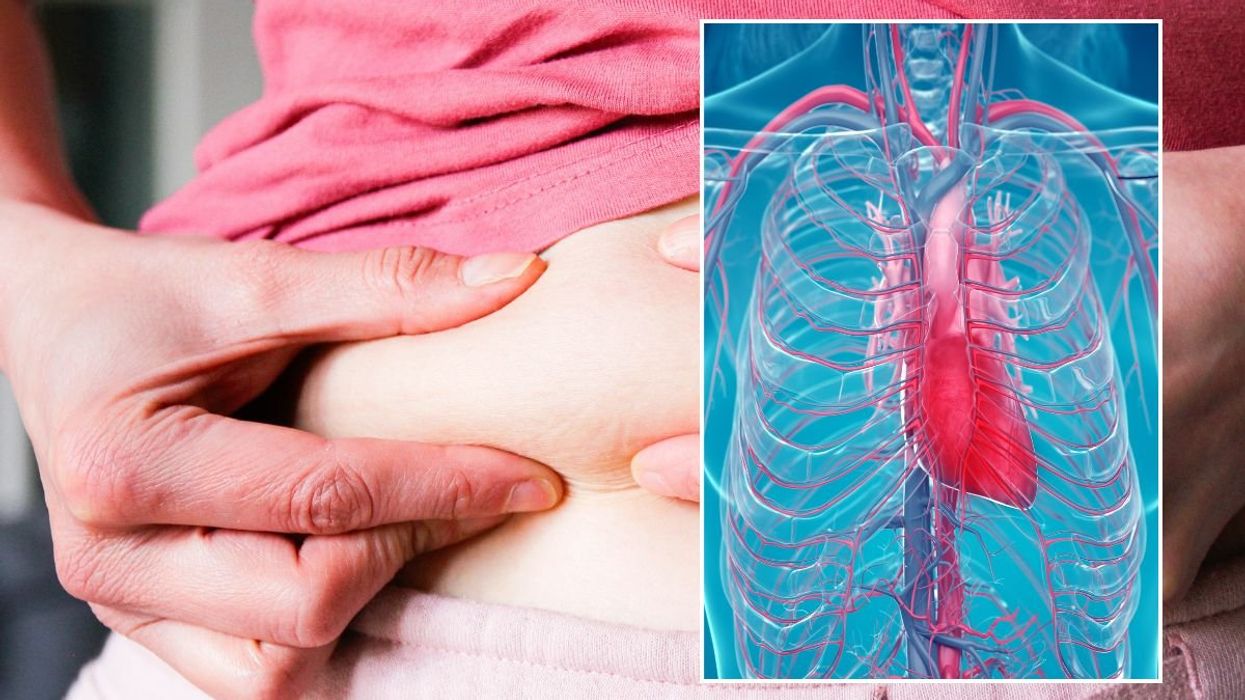 PINCHING FAT AND CORONARY SYSTEM ILLUSTRAION