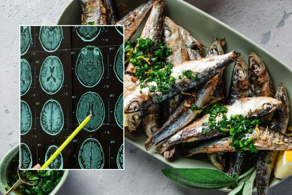 PLATE OF SARDINES and brain scan