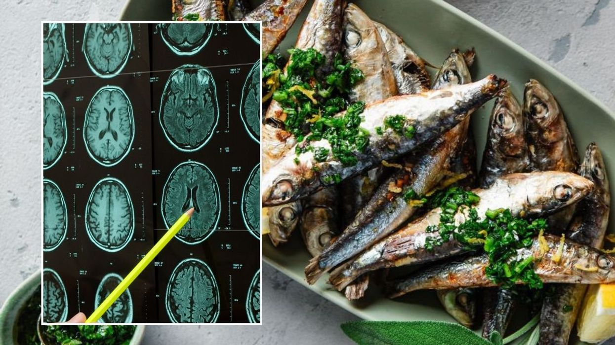 PLATE OF SARDINES and brain scan