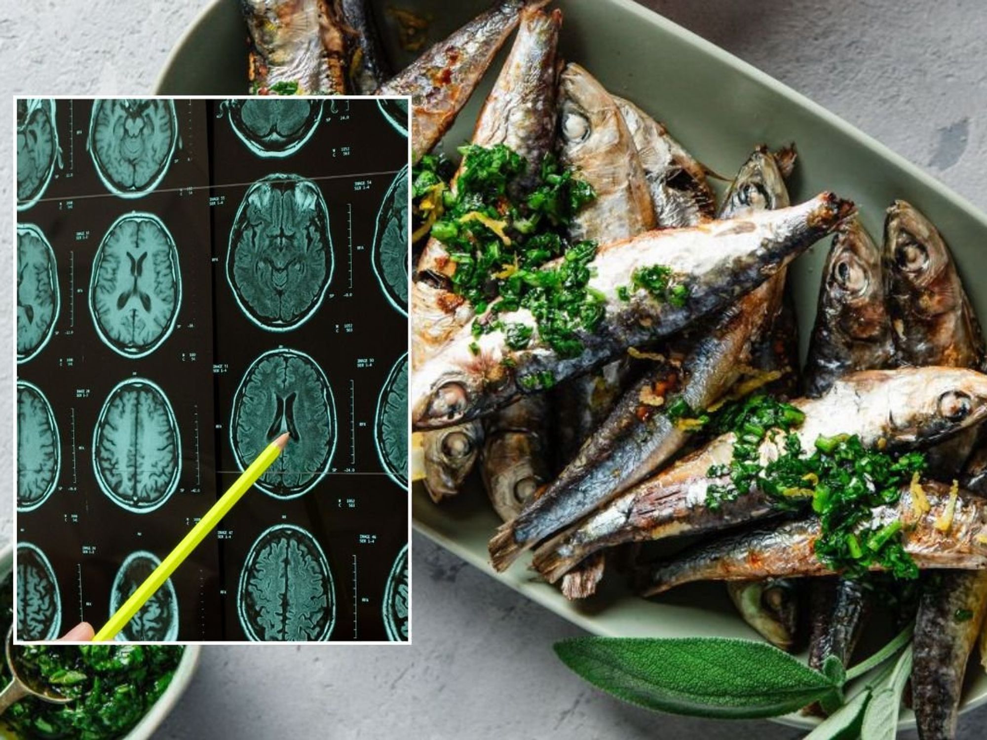 PLATE OF SARDINES and brain scan