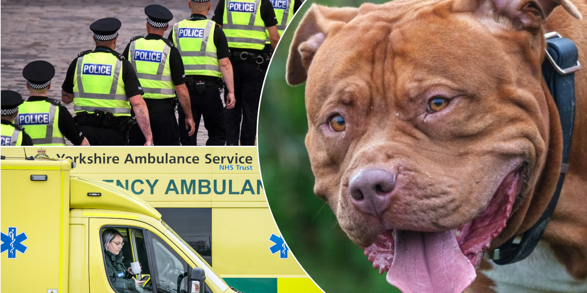 NextImg:Boy, 5, had 'half his scalp ripped off' in horror XL Bully-type dog attack