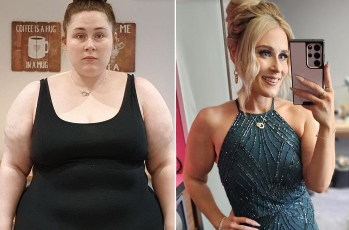 RACHEL BEFORE AND AFTER