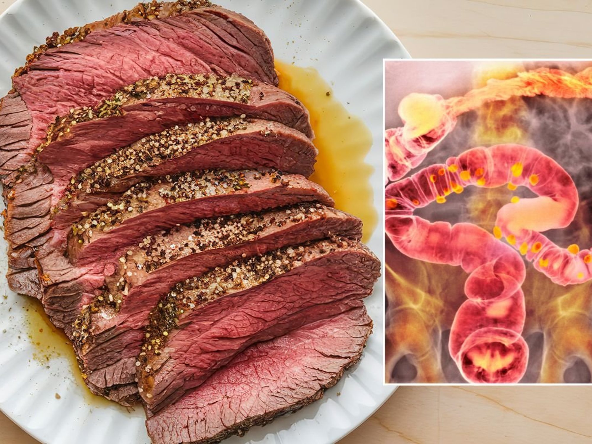red meat and colon