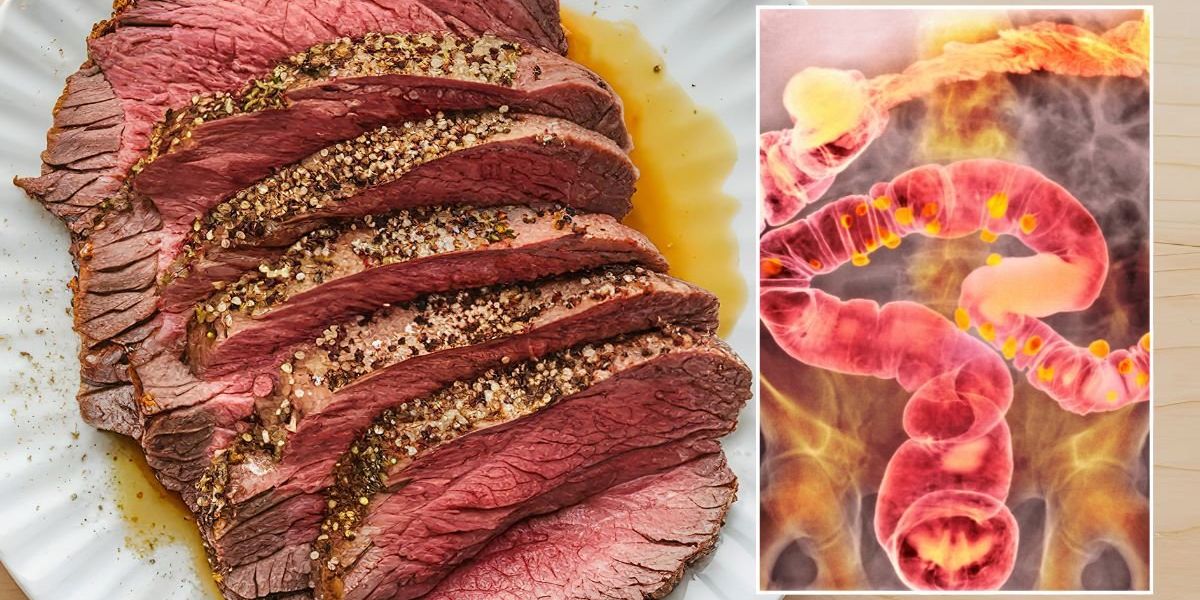 How much meat is too much? Doctor sets record straight as bowel cancer rises in under-50s How much meat is too much? Doctor sets record straight as bowel cancer rises in under-50s