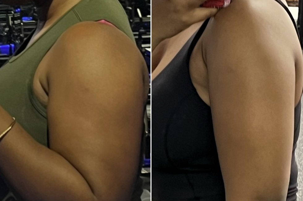 Relah Winde shared her before and after pictures, sharing her progress