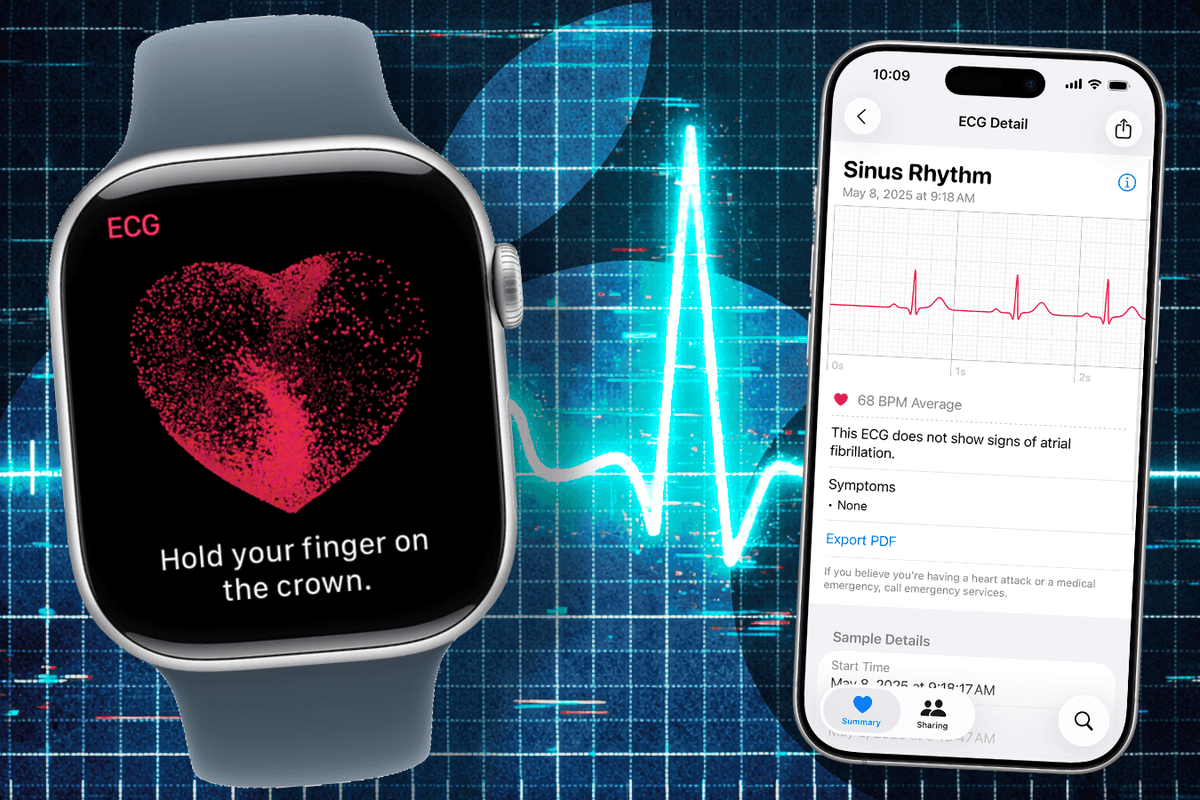 Giving an Apple Watch to patients with heart condition could reduce NHS burden, study shows